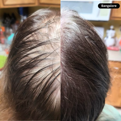 🔥 Advanced Clinical-Grade Red Light Hair Regrowth Therapy Cap